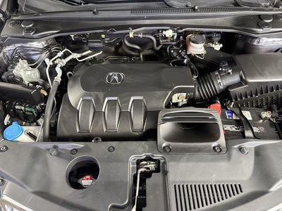 2017 Acura RDX w/Technology Pkg